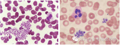 直接稀释于血小板稀释液中,在显微镜下直接计数