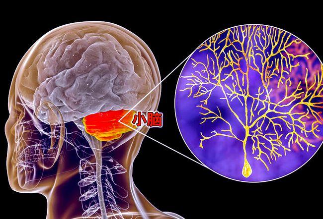 科学常理难以解释的现象:人失去小脑后仍能正常生活三
