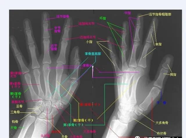 高清腕关节解剖