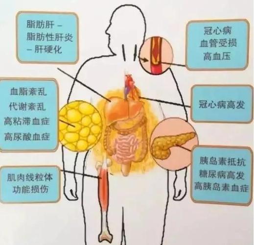 如果人们想要逆转脂肪肝,需要做什么?