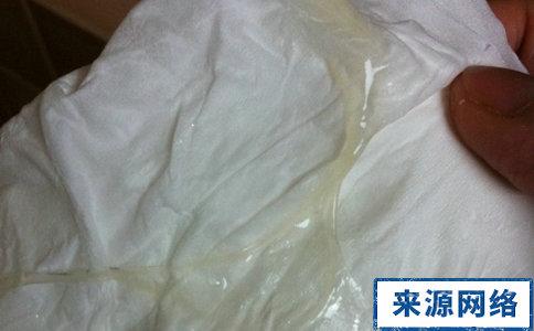 排卵期白带拉丝图片大全 排卵期 妇科