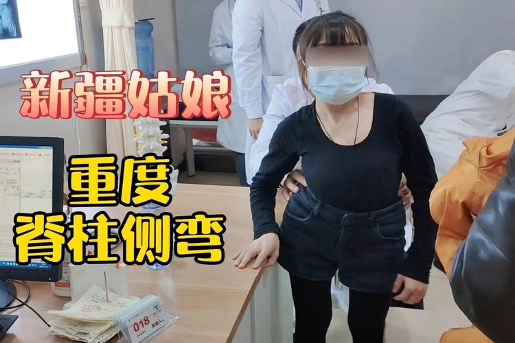 新疆姑娘重度脊柱侧弯,医生说手术效益明显大于负面效益