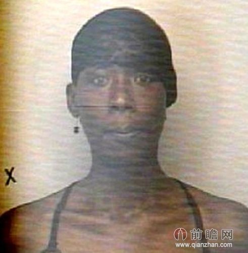 男子嫌工作累切除自己睾丸卖掉切蛋过程直播