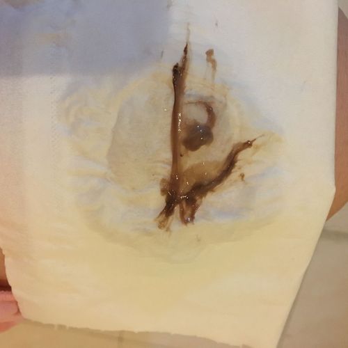 经期第9天 白带是这样的正常吗