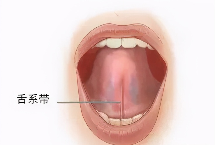 福州5岁男童被剪4次舌系带!多少中国孩子毫无必要地挨了一刀?