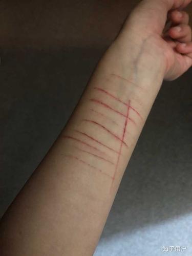 为了一个男生自残值得吗?