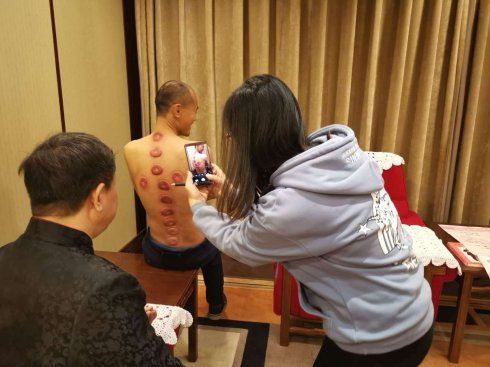 [转载]宇泉罐诊罐疗法被大会组委会评为中国家庭健康的适宜技术推广