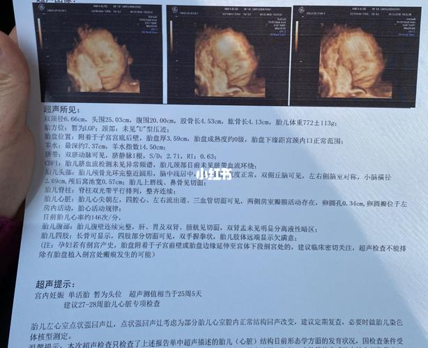 四维彩超能看出男宝女宝吗_胎儿_女宝_四维彩超_胎盘