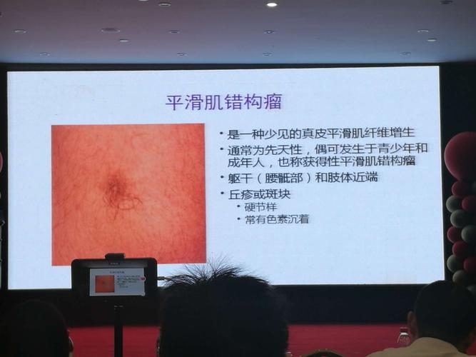 皮肤软组织肿瘤的诊断(3)——复旦大学肿瘤医院王坚