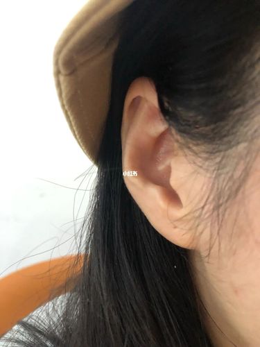 反骨耳?有没有同款耳朵的小姐妹!