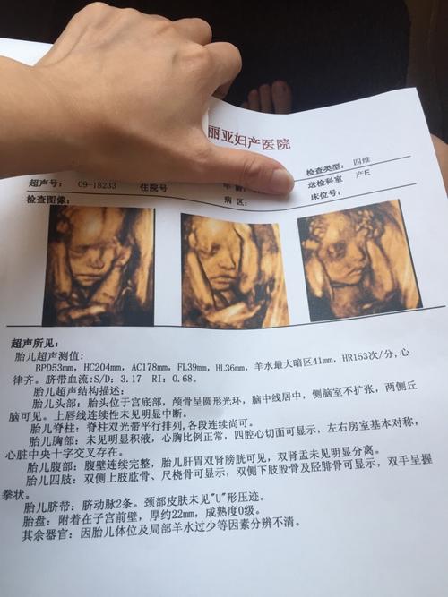 四维彩超四维顺利通过大家看一下男孩女孩_妈妈网孕育社区_妈妈网