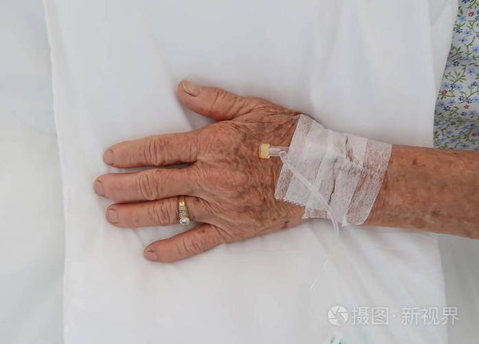 老年妇女手静脉输液.住院病人