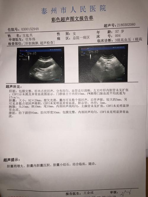 腹部彩超