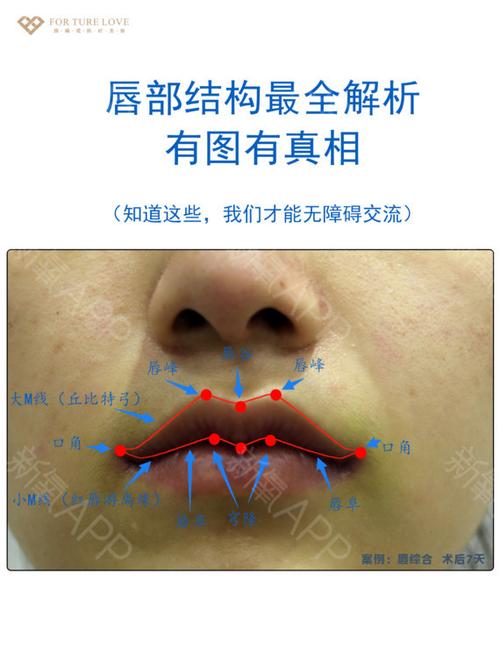 唇部结构最全解析有图有真相