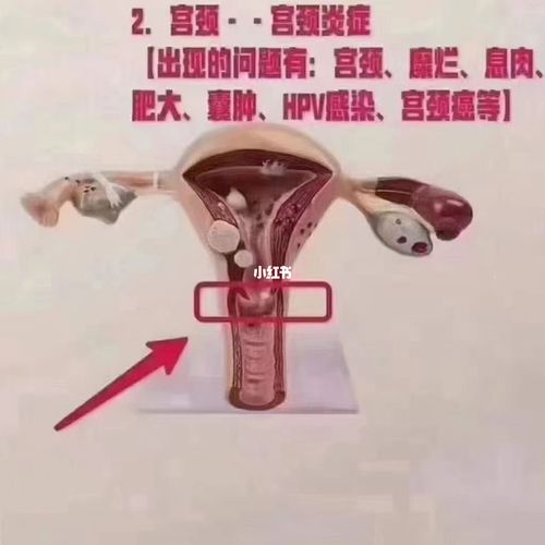 子宫_子宫_健康生活_我的健康生活_医疗健康_医疗健康