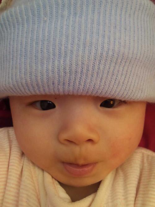 宝宝脸大小不一样.