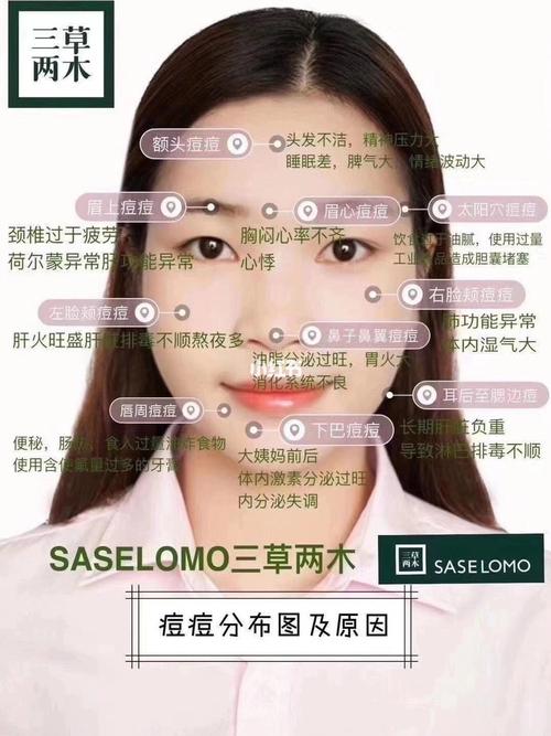 痘痘分布图及原因92_痘痘_痘痘肌_护肤小知识_长痘痘_排毒_美妆