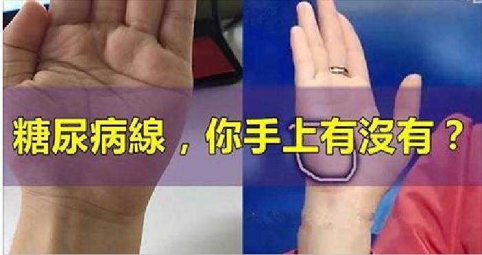 这条糖尿病线,你手上有没有?不花一分钱,避免截肢,失明!