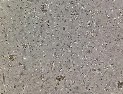 与红细胞同框,它们到底是什么?