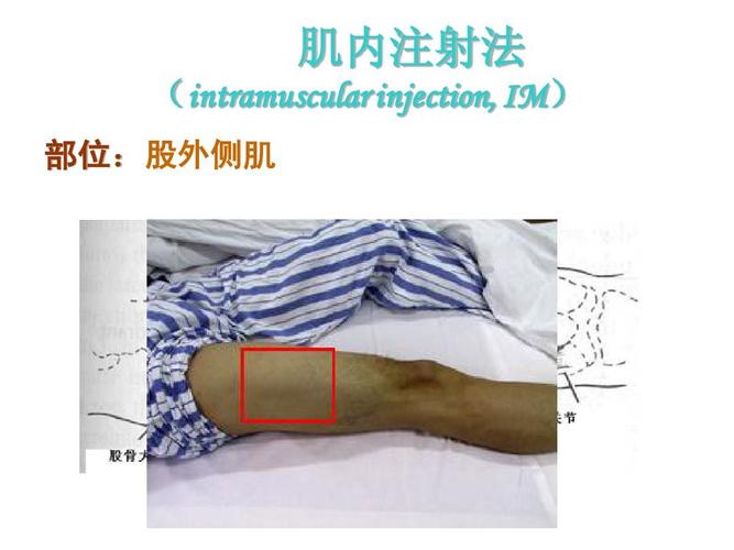 肌内注射法 (intramuscular injection, im) im) 部位: 部位:股外侧肌