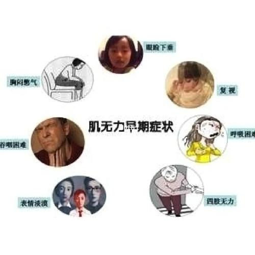 肌营养不良的症状_肌无力_天通苑攻略_腰椎_骨盆_颧骨