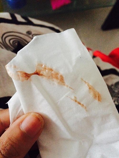 母猫羊水破了,小猫没有生出来,他一直在舔,肚子里的小猫肯.