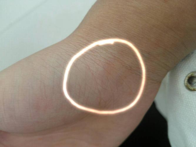 手腕这里好疼,被圈出来的地方,揉起来像淋巴一样,怎么