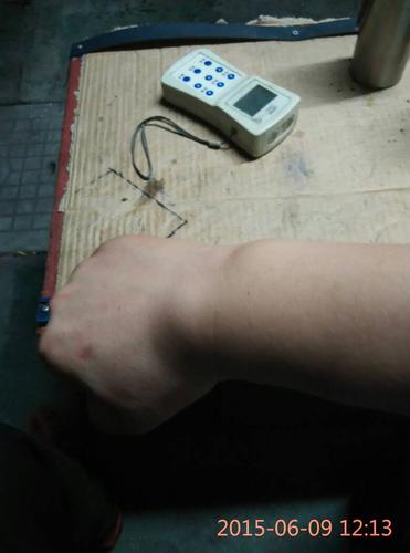 大家看下我的右手掌与胳膊的关节处有个凸出来的样子摸着像骨头但是不