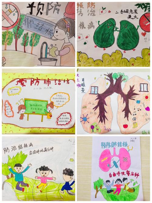 结核病又称为痨病和"白色瘟疫"