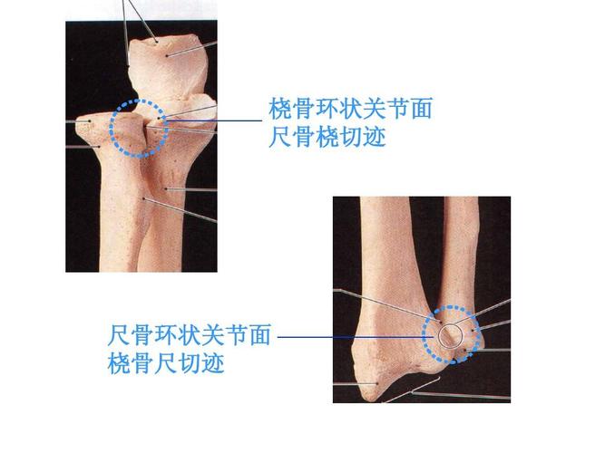 课件,很好的 桡骨环状关节面 尺骨桡切迹 尺骨环状关节面 桡骨尺切迹