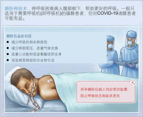 知识更新:ards的俯卧位通气
