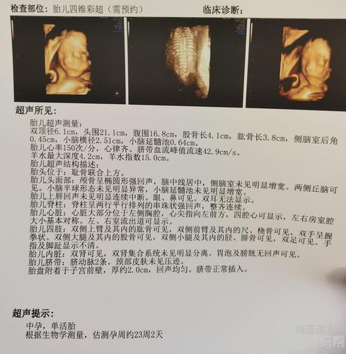 新鲜出炉的四维照,全程很配合,除了比较爱动,能不能看出男孩