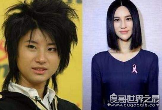 尚雯婕整容前后照片对比换头术后遗症效果惊悚