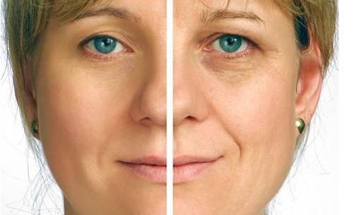 霍纳综合征,是一种可以治愈的疾病,早发现治愈的希望便会提高