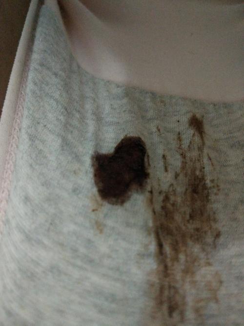 这几天不知道怎么回事下身流出褐色分泌物
