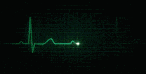 当前位置:>好大夫在线>幺天保> 常见心律失常:心动过缓与心脏骤停由于