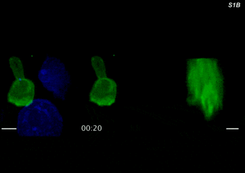 科学家拍摄到 t 细胞追杀癌细胞的矫健身姿及全过程(多动图) | 科学大