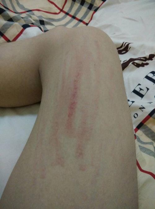 为什么轻轻抓一下就会这样