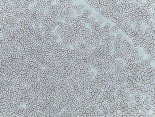 然后笔者使用生理盐水洗涤该红细胞三遍后,在显微镜下可见(如下图片)