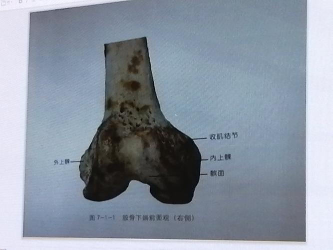 股骨下端前面观