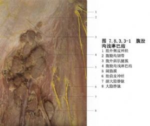 腹股沟淋巴结肿大发炎化脓脓破了怎.