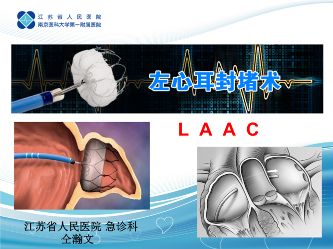 左心耳封堵术课件.ppt