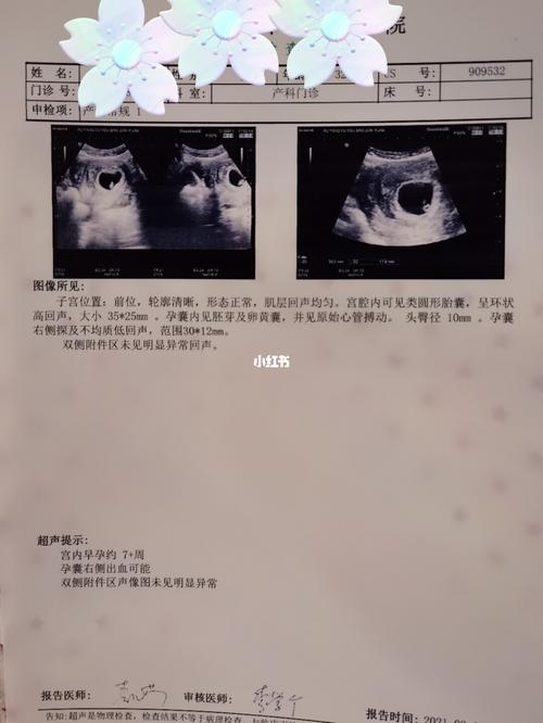 早孕7周突有褐色分泌物_早孕褐色分泌物_母婴_孕产经验