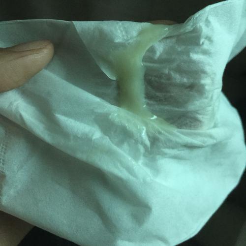 这个白带颜色正常吗?