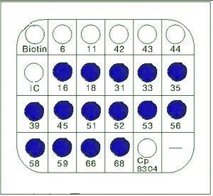 早发现hpv病毒远离子宫颈癌(组图)