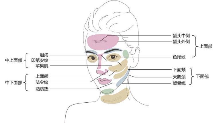 如何改善面部皮肤松弛下垂