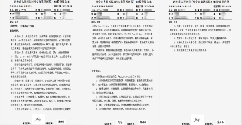 人民医院(西安市第四医院):航天城院区医学影像中心开展全身类pet检查