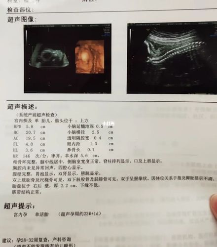 从b超到见面,我的男孩(附四维对比照)_四维彩超_b超_孕期日记_怀孕