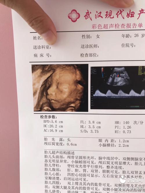 祩5 5是我闺女24周的四维彩超,一次过