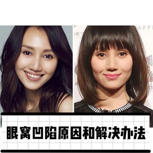 这篇给宝宝们讲讲眼窝凹陷的原因和解决办法